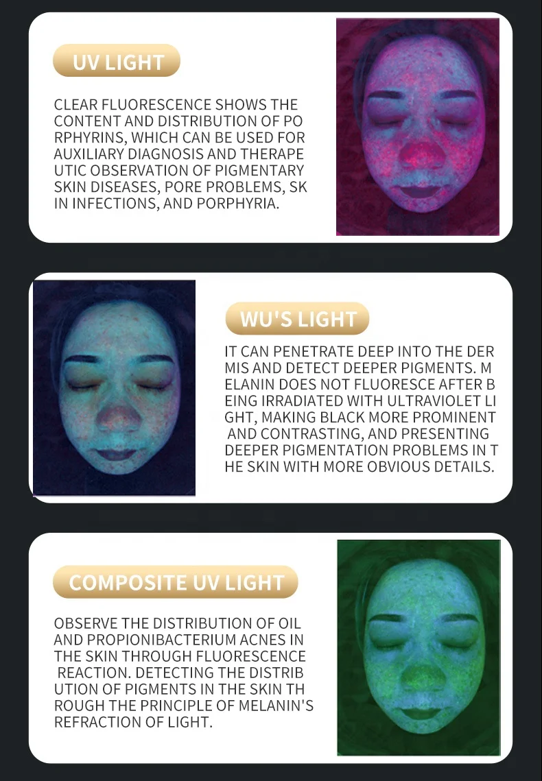 Upgraded X5 3D Ai Skin Image Analyzer High Definition Pixels Whole Facial Scanning Multi Spectrum Moisture Scalp Detection