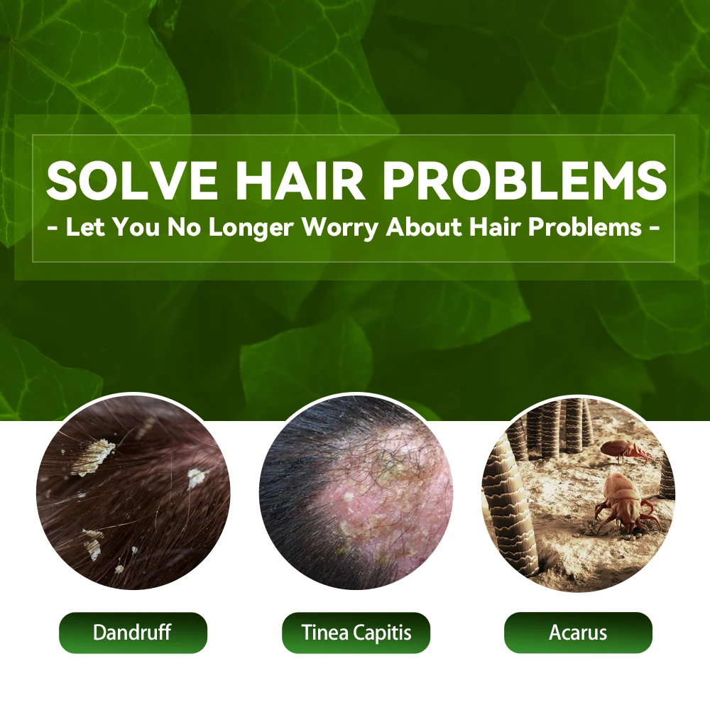 EELHOE Hair Cleaning Shampoo Anti Dandruff Remove Mites Relieve Itching Oil Control Scalp Cleaning Refreshing Hair Shampoo