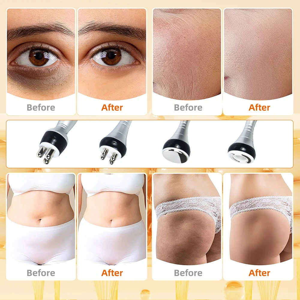 Nourishbel 4In1 40k Cavitation Ultrasonic Slimming Machine Body Care Vacuum Suction Anti-Wrinkle Rejuvenation Skin Lift Tighten