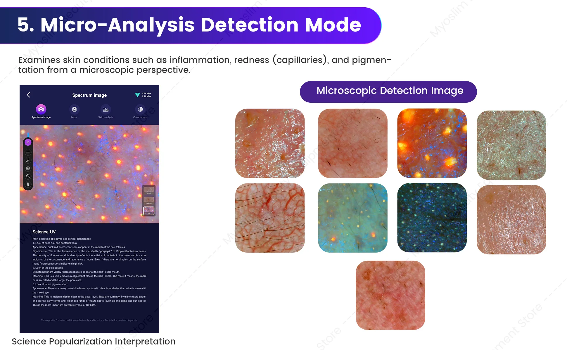 X3 Prro Skin Analyzer Machine 15.6 Inch 3D Facial AI Skin Care Scanner Hair Analysis 8 Light Spectrum for Business Beauty Care