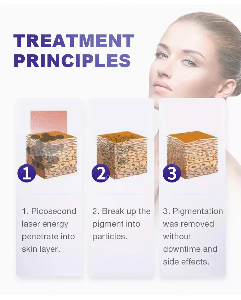 2-In-1 Soprano Diode Picosecond Lase Machine Permanent Ice-Point Hair Removal 755 808 1064nm 4 Wavelengths CE