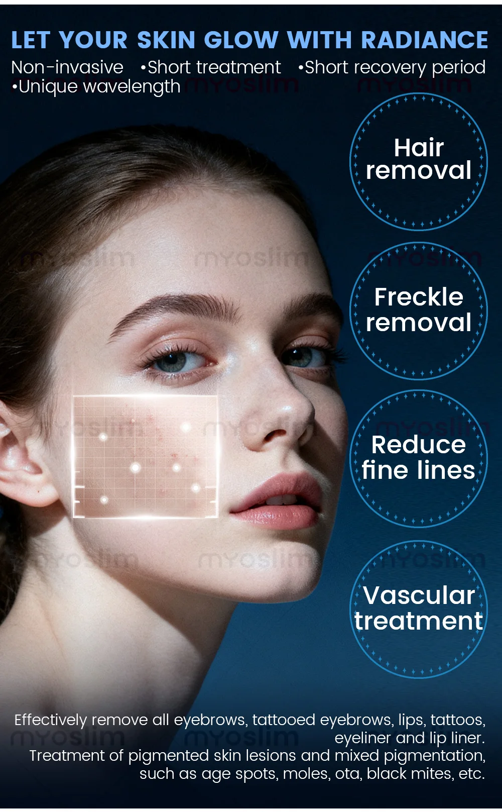 7000W 4in1 Soprano Titanium Ice Platinum Diode Laser 4 Wavelength ND:YAG RF IPL OPT Machine Painless Hair Removal Machine