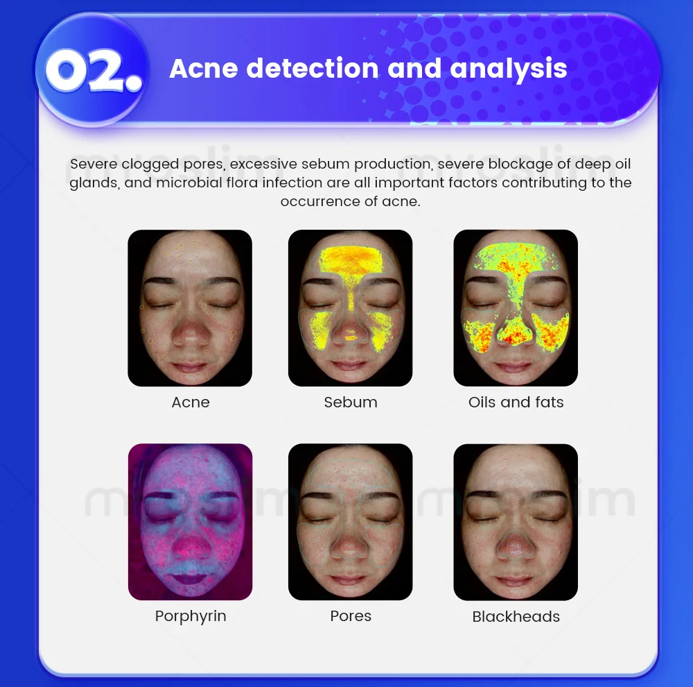 21.5 Inch X5 Facial Skin Analyzer 3D AI Hair Analysis Machine 8 Light Spectrum Skin Analysis Scanner For Business Beauty Care