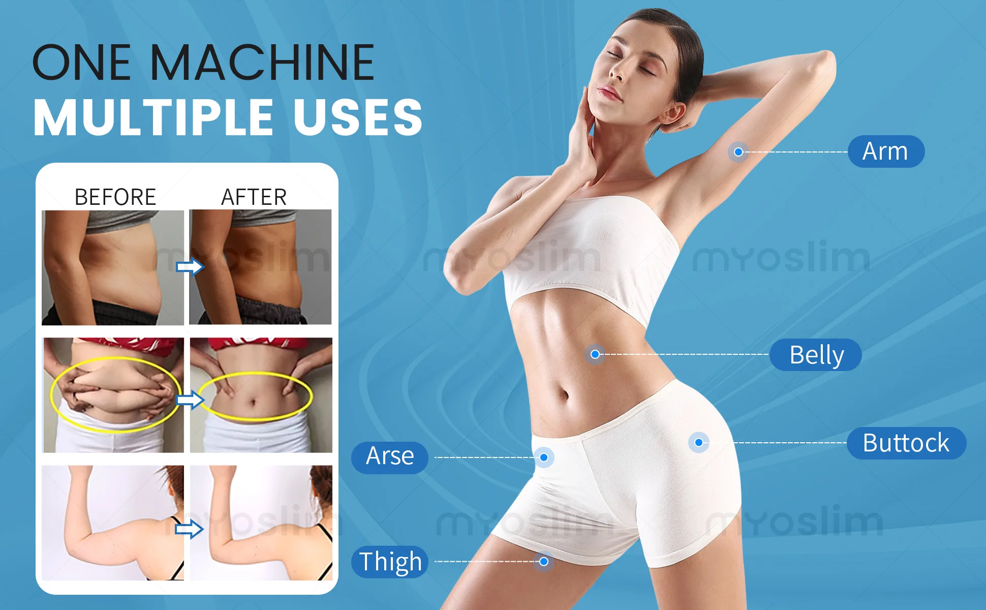 EMS Body Sculpting Machine MYOslim Muscle Building Fat Burning Abdominal Sculpting 15T 6500W Weight Lose Machine