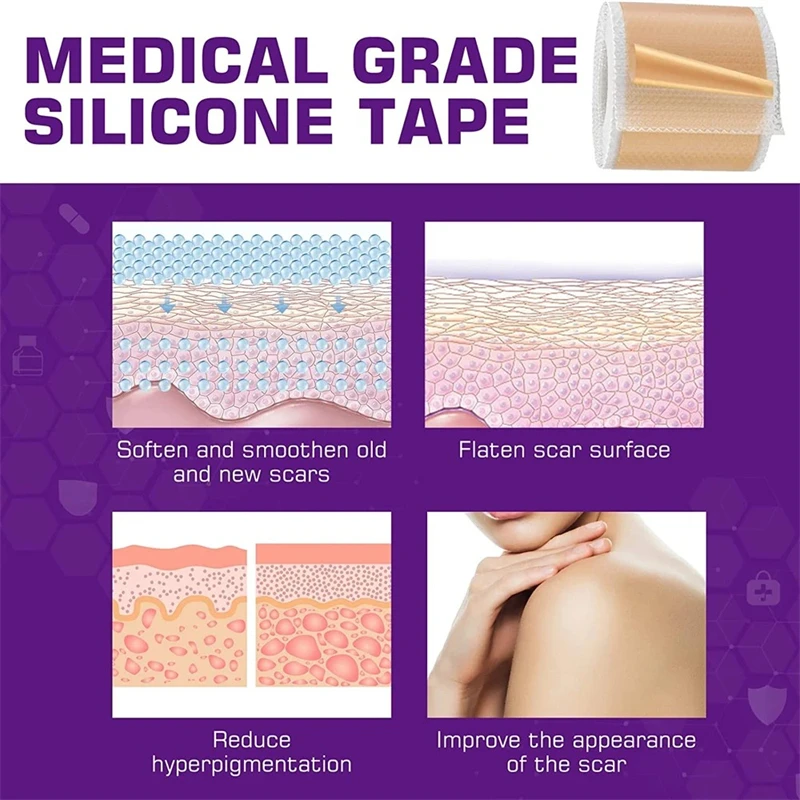 Waterproof & Reusable Silicone Scar Tape – Breathable, Skin-Friendly Adhesive for Ear Protection & Discreet Coverage