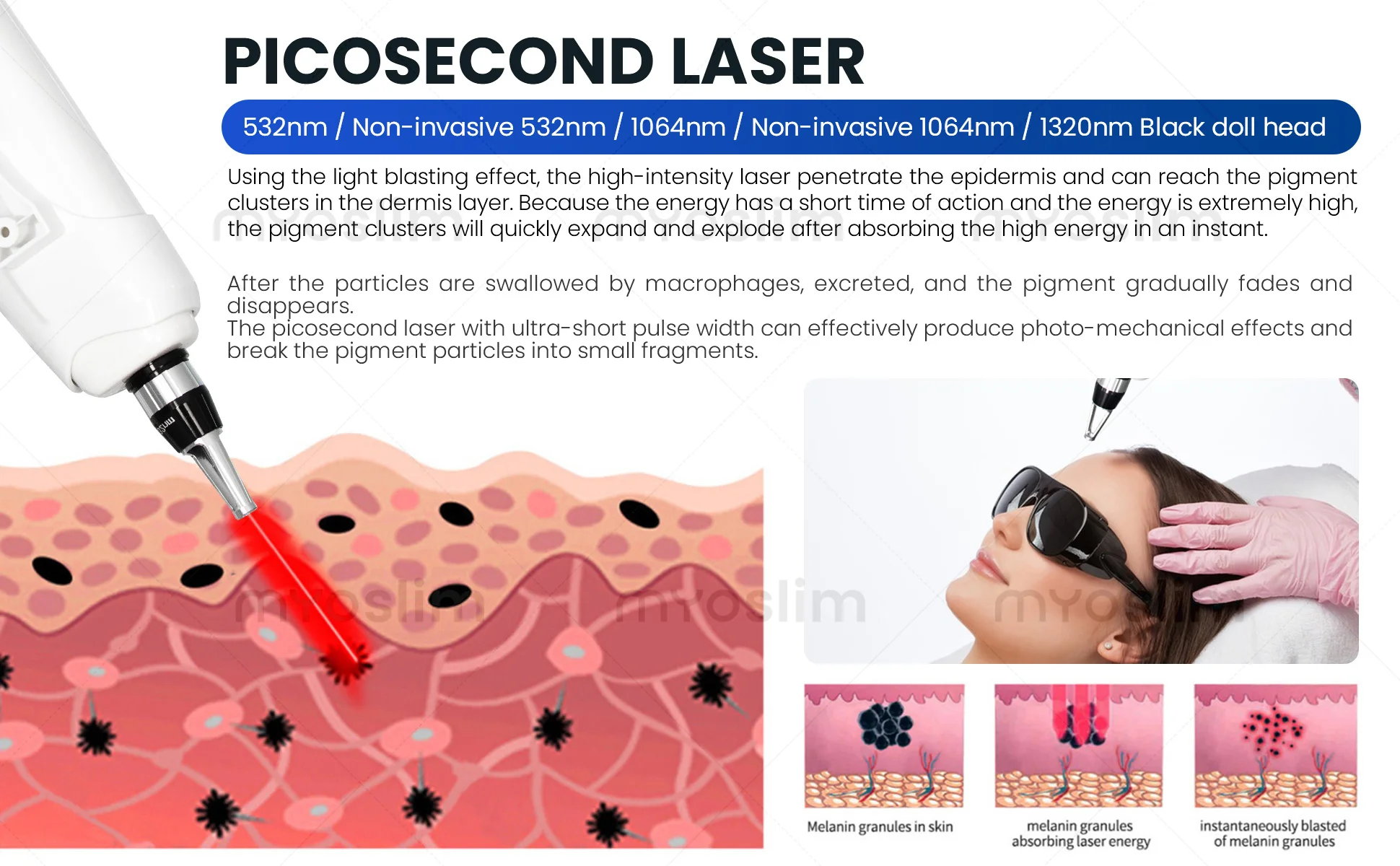 5000W Diode 4 In 1 Opt Ipl Hair Removal Machine 4 Wavelengt Newest Picosecond Nd Yag Tattoo Removal Carbon Peeling RF