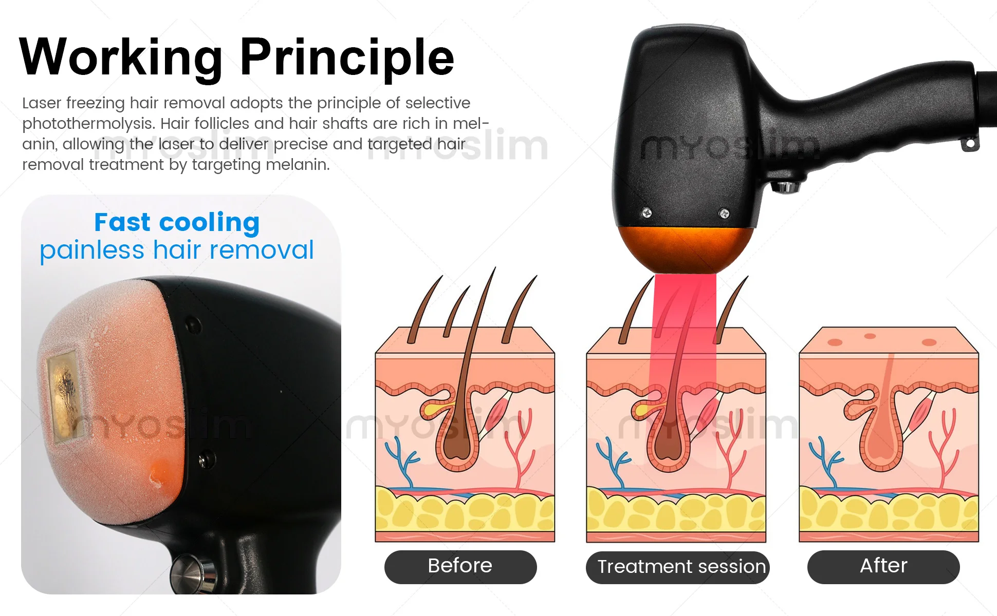 808 Diode Hair Removal Lase Machine FAC 5000W 4 Wavelength Permanent Painless Skin Rejuvenation Firming Body Alexandrit Epilator
