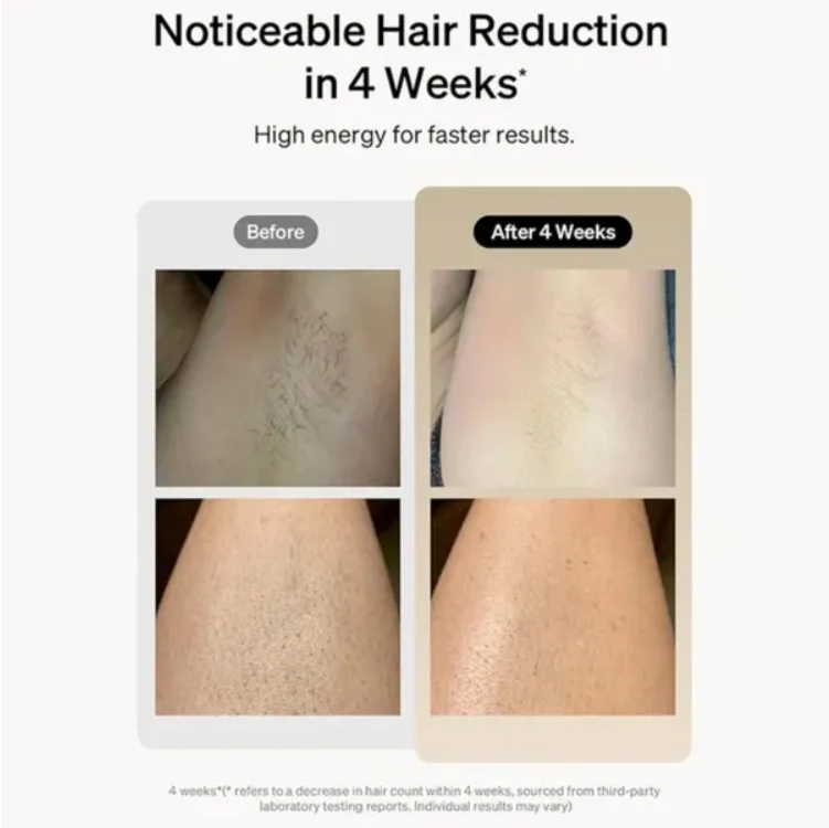 Professional Laser Epilator IPL Hair Removal Body Leg Depilatory Devic 5 Levels Epilator Painless Electric Epilator Machine