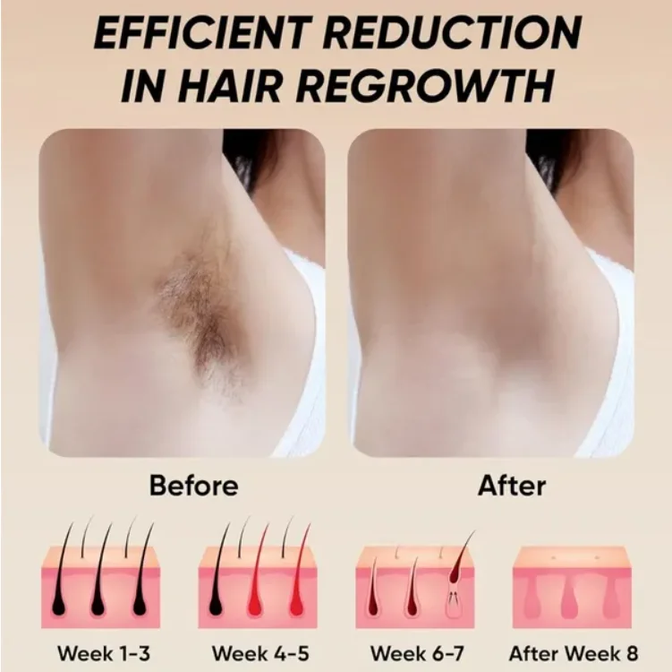 Professional Laser Epilator IPL Hair Removal Body Leg Depilatory Devic 5 Levels Epilator Painless Electric Epilator Machine