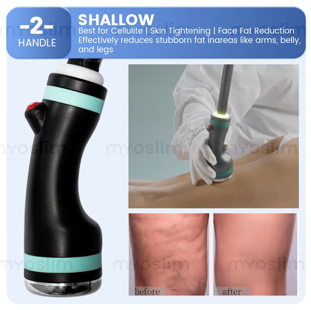 High Performance Cool Waves RF Body Slimming Machine with 3 Handles for Facial Lifting Weight Loss and Skin Firming