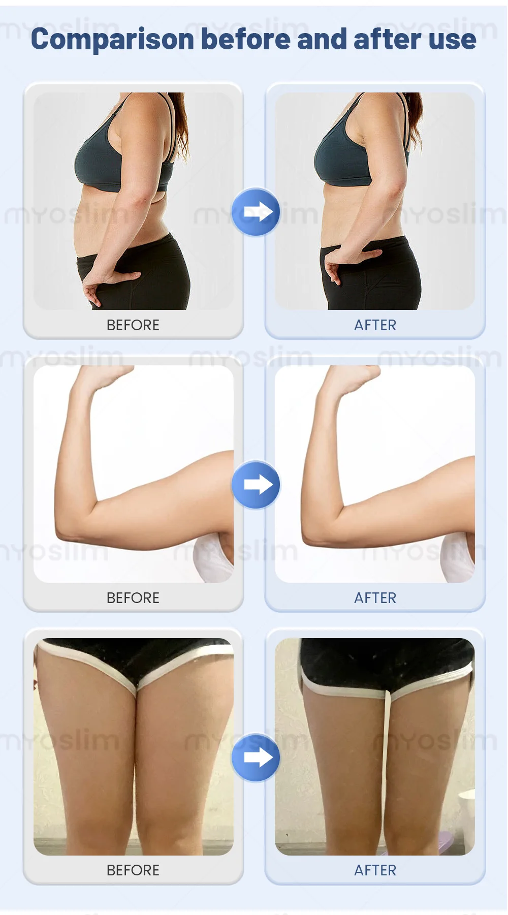 High Performance Cool Waves RF Body Slimming Machine with 3 Handles for Facial Lifting Weight Loss and Skin Firming