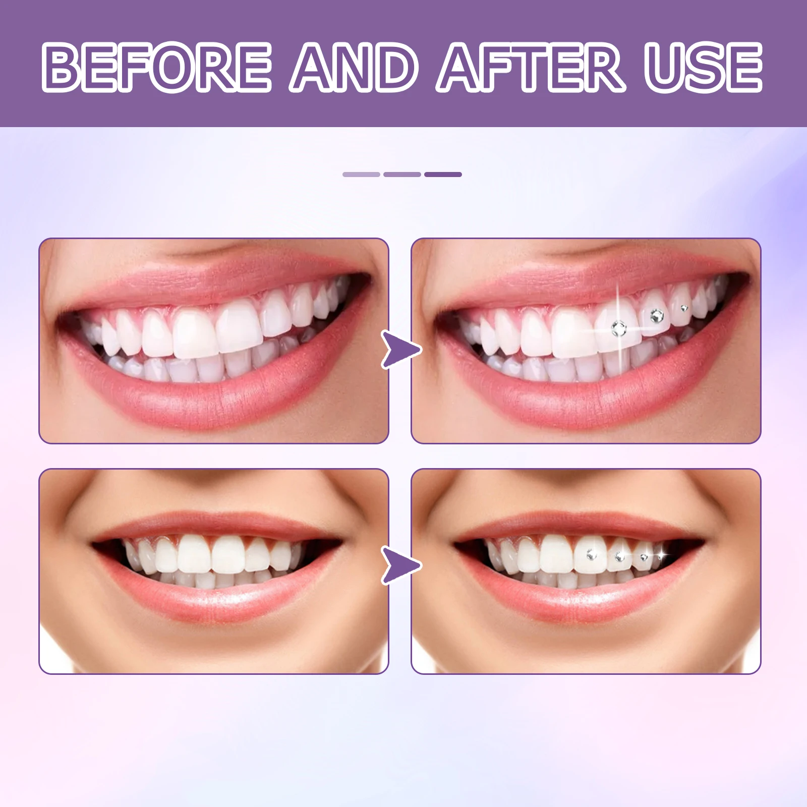 Tooth Gem Glue Dental Adhesive for Tooth Gems Diamond Kit Glue Teeth Crystal Jewelry Sturdy Tooth Jewelry Orthodontic Gel