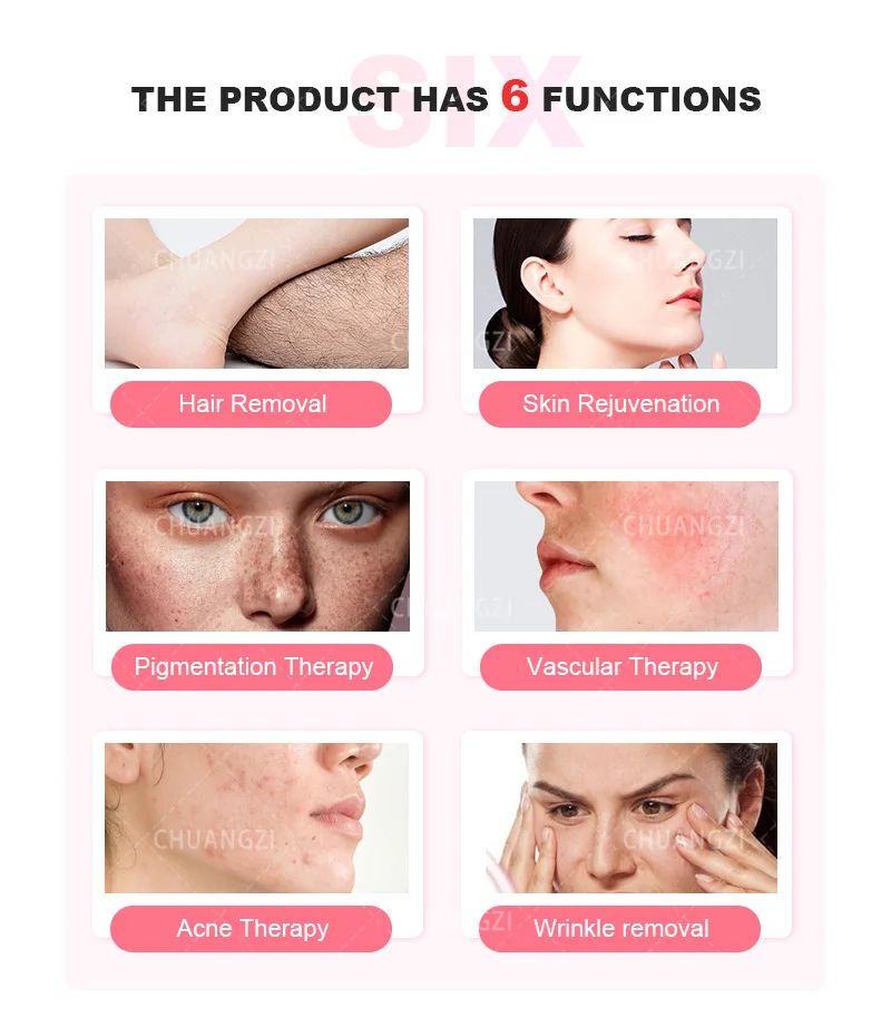 OPT 3 Wavelength Portable Hair Removal Laser Machine Professional Equipment For Painless Hair Removal And Skin Rejuvenation HOT