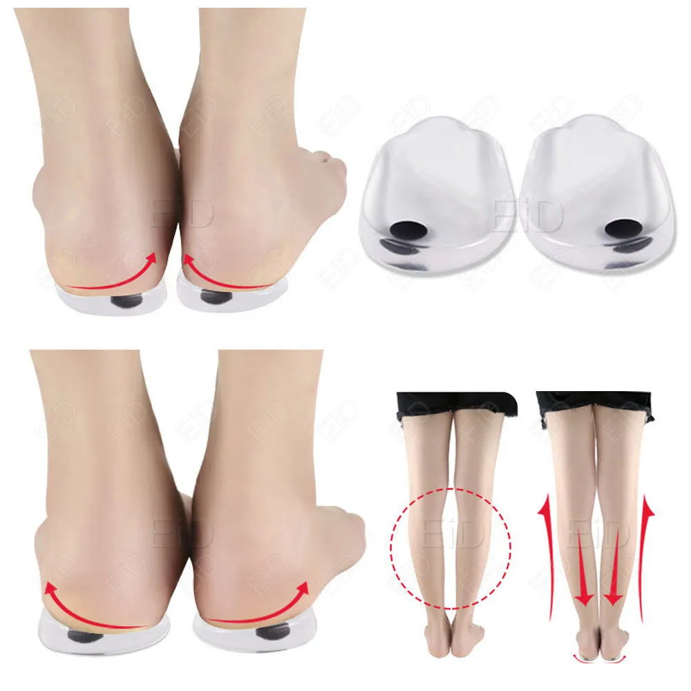 1 Pair Magnets Silicon Orthopedic Insoles Foot Care Tool For Men Women Health Care O/X Type Legs Knee Varus Correction Heel Pads