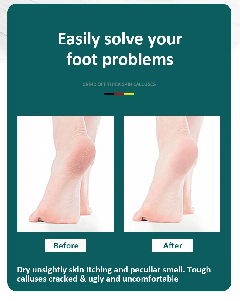 High-Quality Foot File Double Sided Callus Remover For Dead Skin Professional Pedicure Tools Callous Scraper