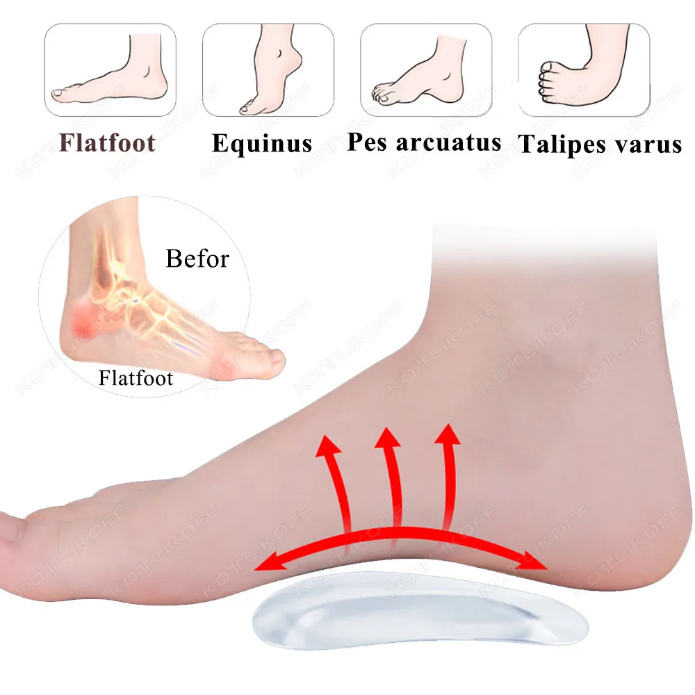 Orthotic Arch Foot Care Comfort Pain Silicone Orthopedic Insoles for Shoes Women Flat Feet Arch Support Self-adhesive Foot Pads