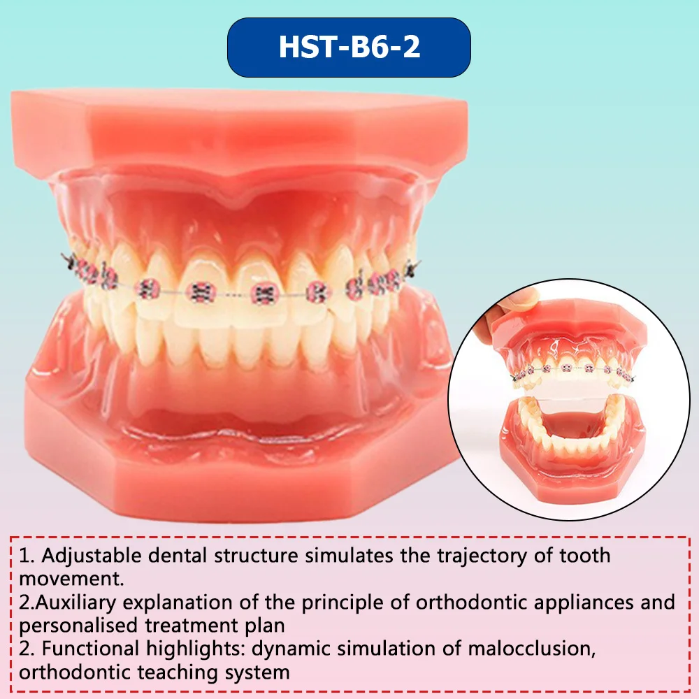AG Orthodontic Teaching Model Oral Model Half Ceramic Half Metal Bracket for Dentist Doctor-patient Communication Tool