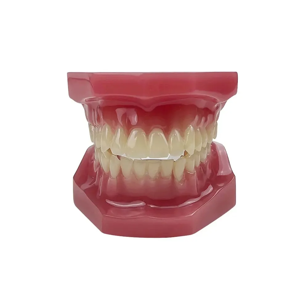 AG Orthodontic Teaching Model Oral Model Half Ceramic Half Metal Bracket for Dentist Doctor-patient Communication Tool
