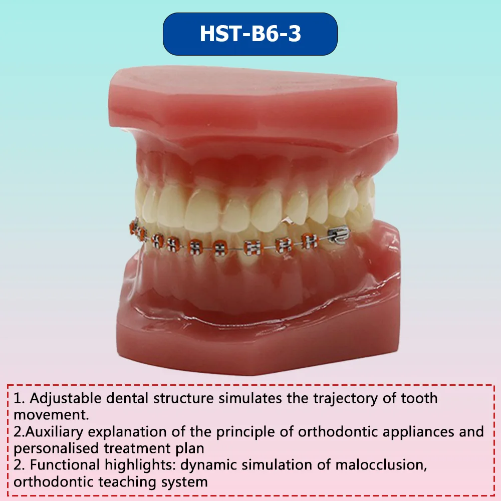 AG Orthodontic Teaching Model Oral Model Half Ceramic Half Metal Bracket for Dentist Doctor-patient Communication Tool