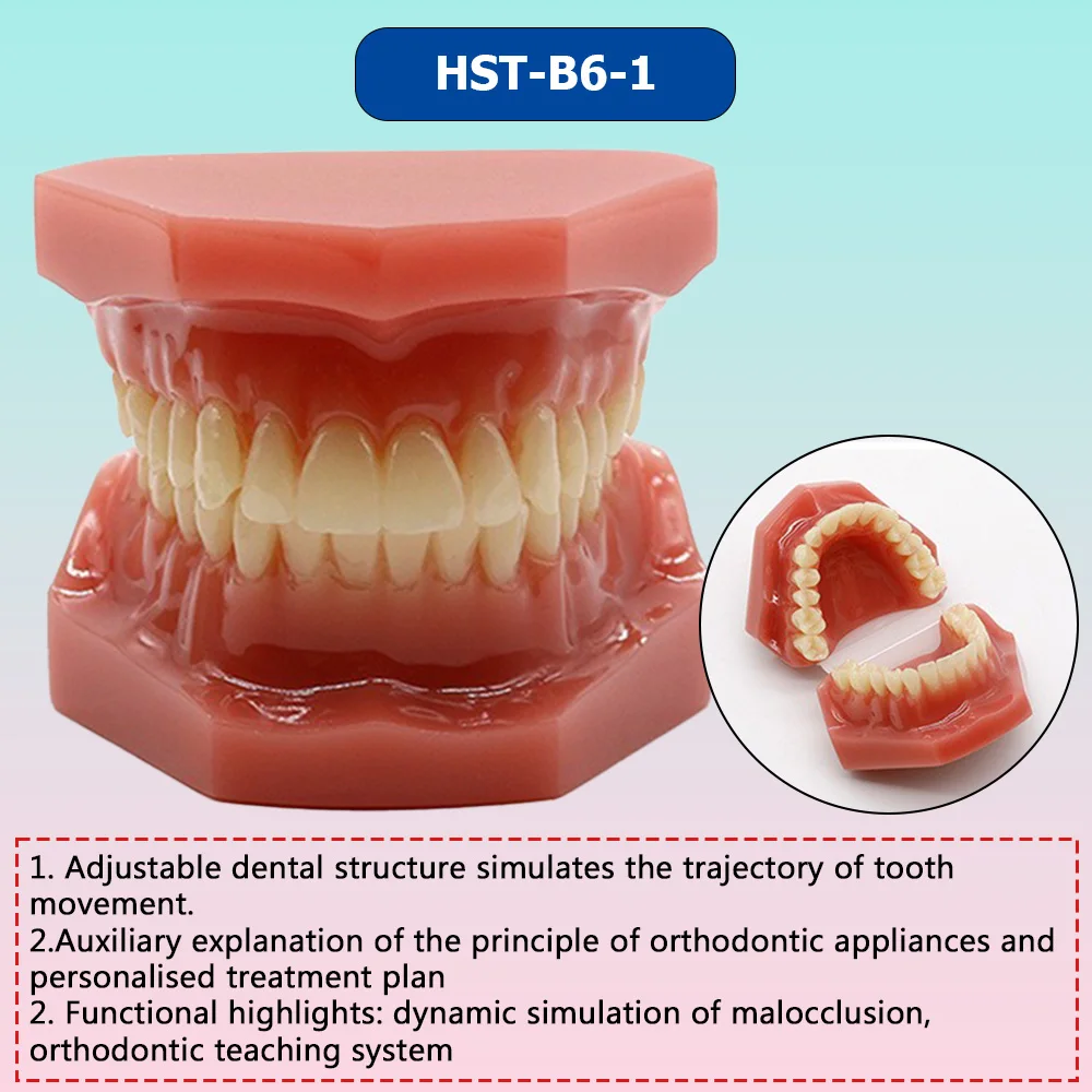 AG Orthodontic Teaching Model Oral Model Half Ceramic Half Metal Bracket for Dentist Doctor-patient Communication Tool