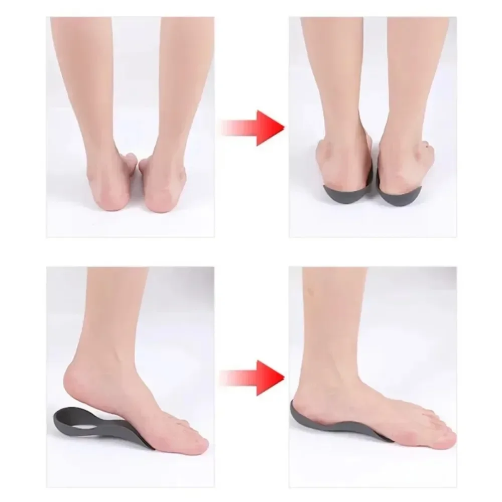 1 Pair Orthotic Insoles For Flat Feet O-Shaped Legs And Plantar Fasciitis - Unisex Arch Support Shoe Inserts