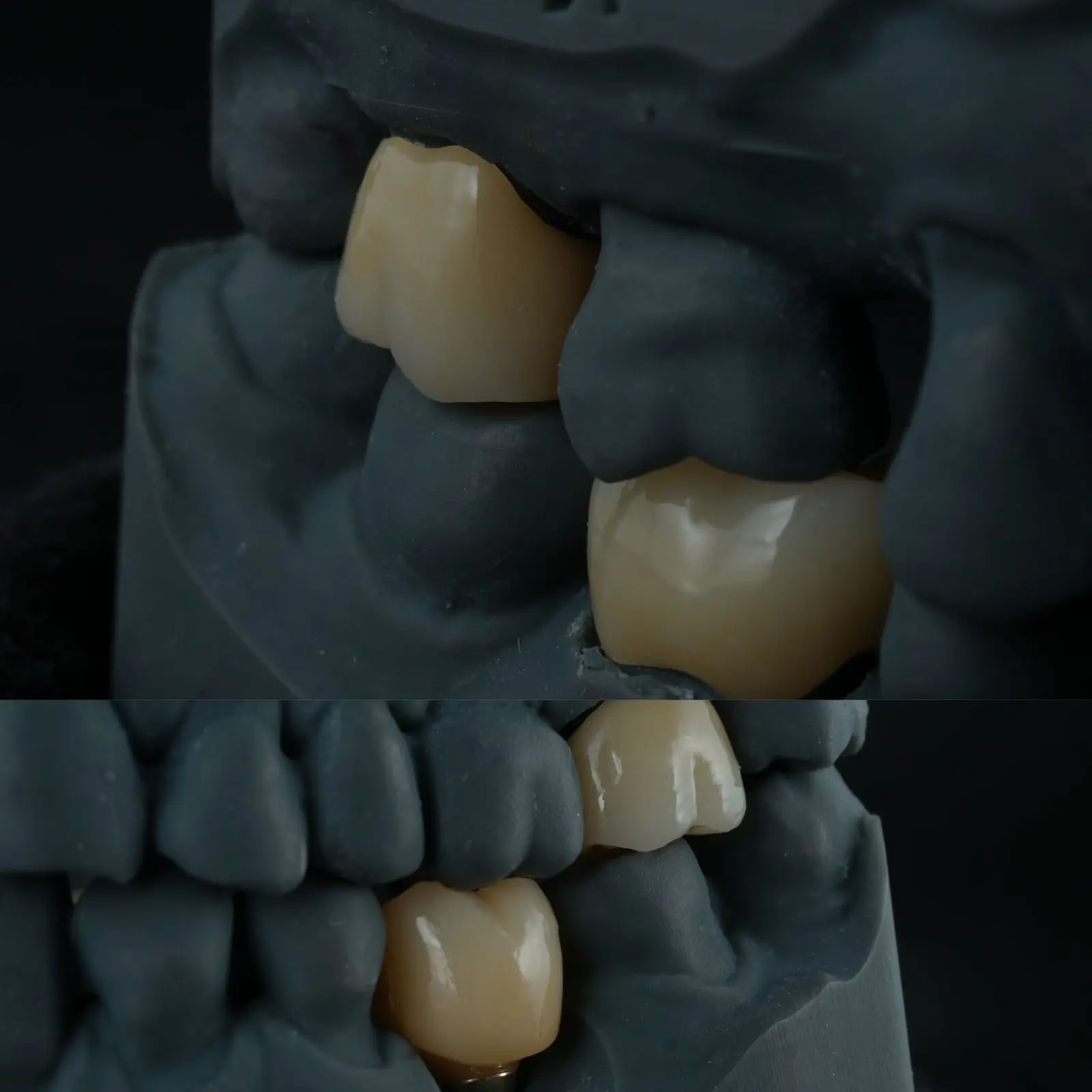 XANGTECH Dental Lab Use Ceramic Power Glaze Paste For Zirconia Full Crown Staining