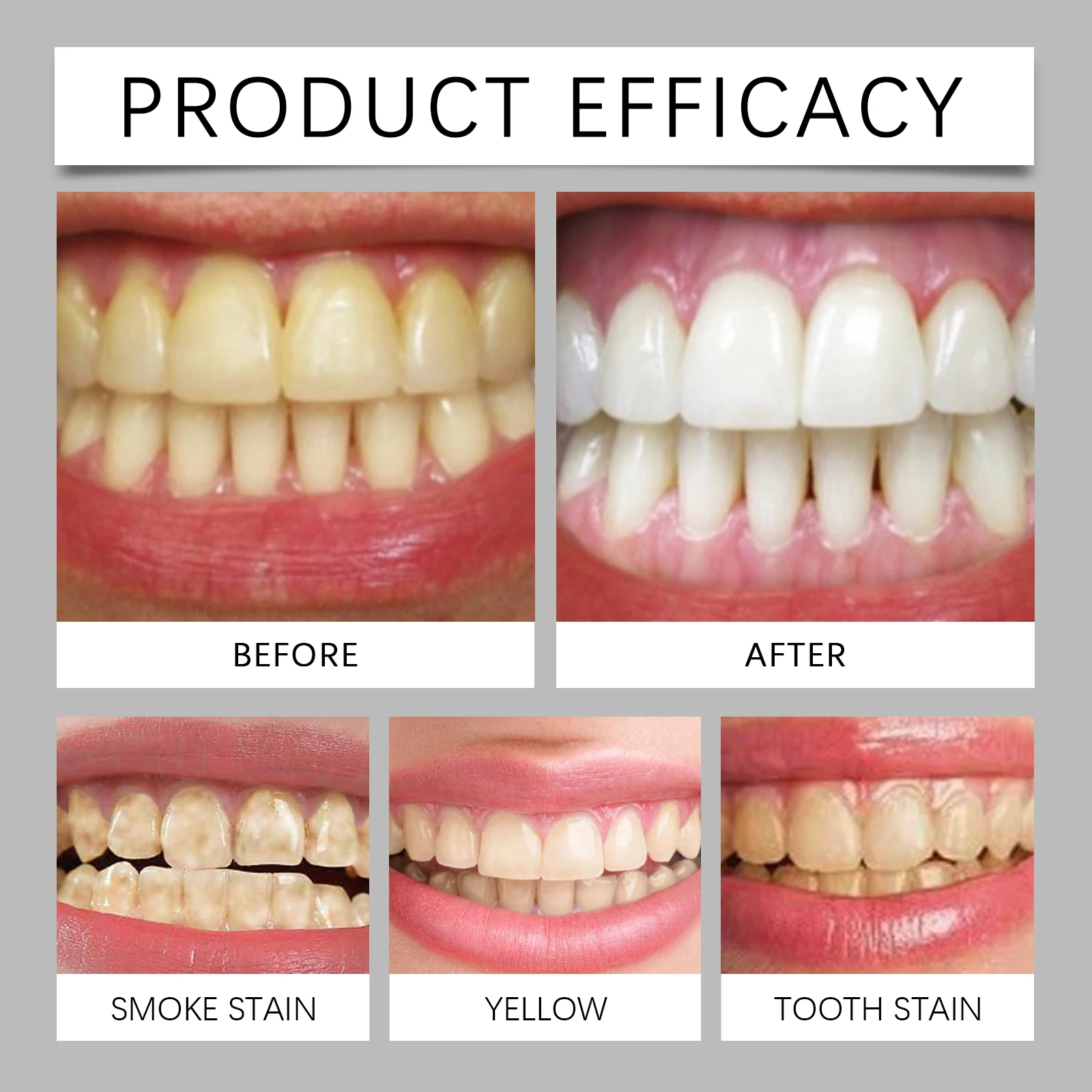 Hydroxyapatite Teeth Whitening Powder Professional Oral Care Stain Removal For White Teeth Cleaning Fresh Breath Dental Care
