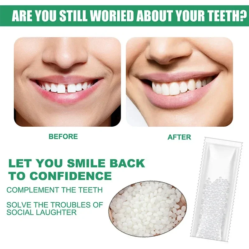 5-100g Moldable False Teeth Tooth Repair Granules Tooth Beads Temporary Filling For Rooth Broken Tooth Repair Kit Thermal Fit