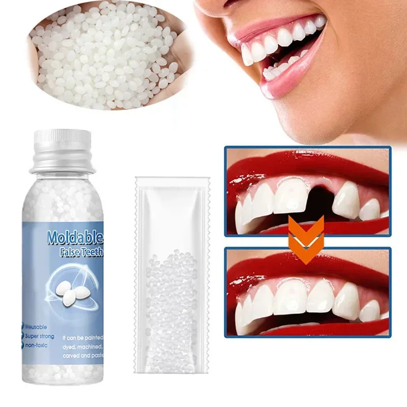 5-100g Moldable False Teeth Tooth Repair Granules Tooth Beads Temporary Filling For Rooth Broken Tooth Repair Kit Thermal Fit