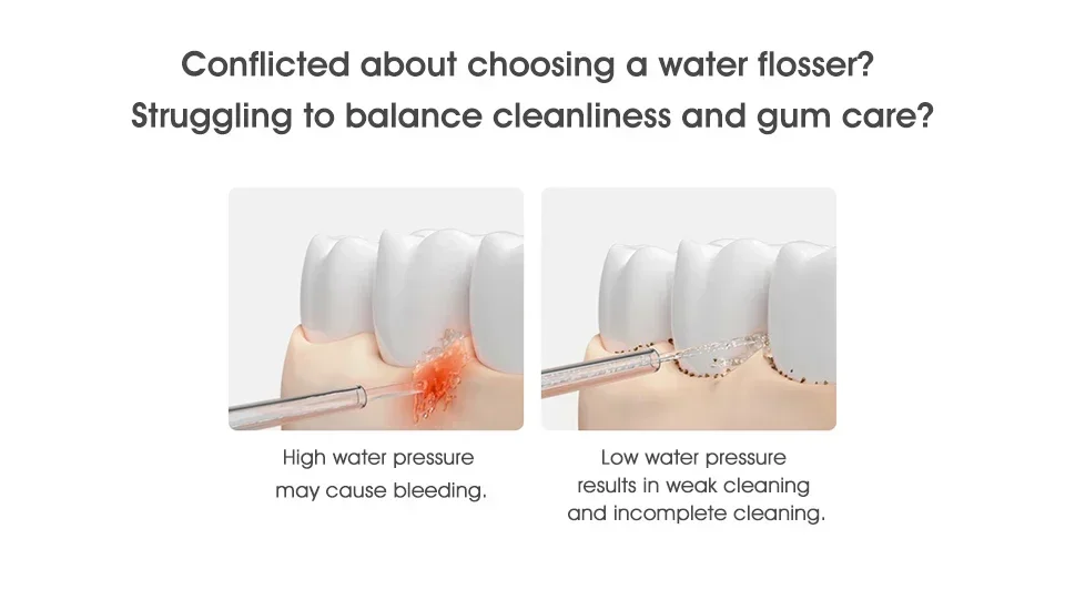 Xiaomi Mijia Oral Irrigator 2, Portable Electric Water Flosser 200ml Type-C Charge 3 Modes for Teeth/Gum Cleaning 2 Nozzles