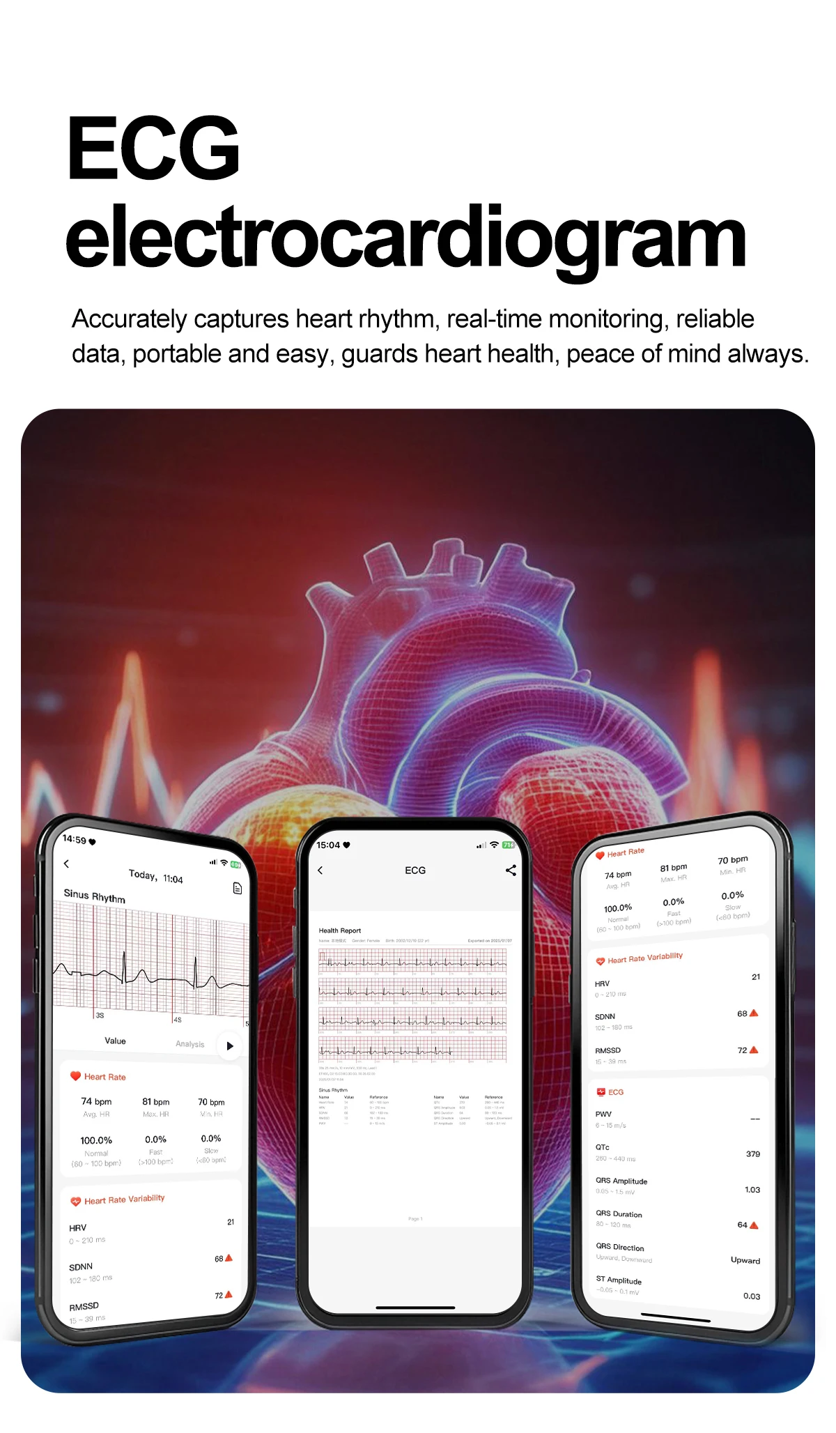 2026 New Body Fat Analysis Health Smart Watch For Men Women ECG Heart Uric Acid Blood Pressure 2.0" AMOLED Clock Call Smartwatch