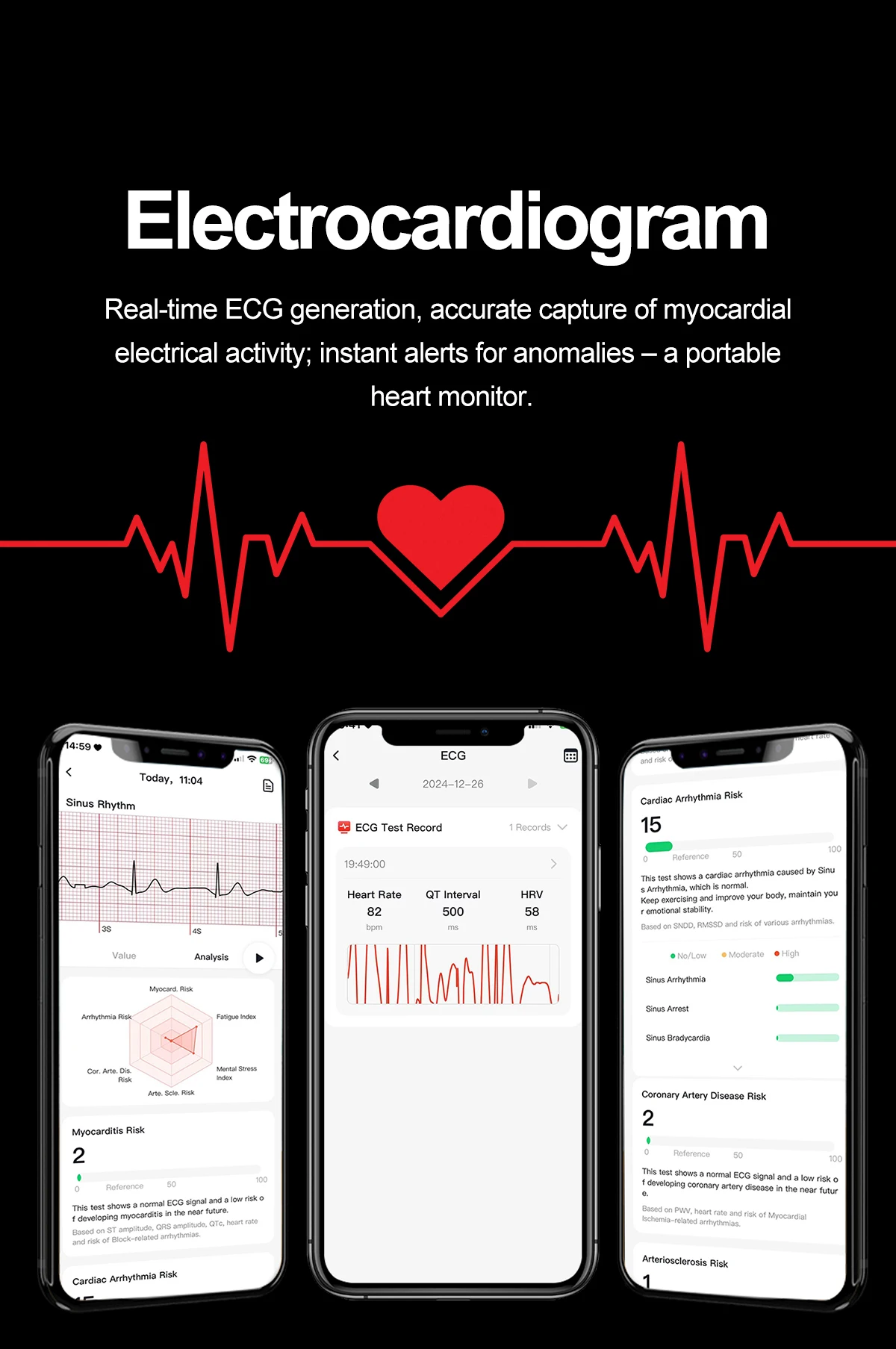 2026 New Air Pump Airbag Smart Watch High Precision Dynamic Blood Pressure Monitor ECG Heart Rate Health Smart watch For Adult