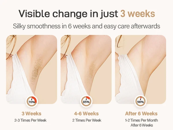990000 Flashes Hair Removal for Women and Men IPL Hair Removal Body Bikini and Facial Areas Painless Permanent HairRemoval