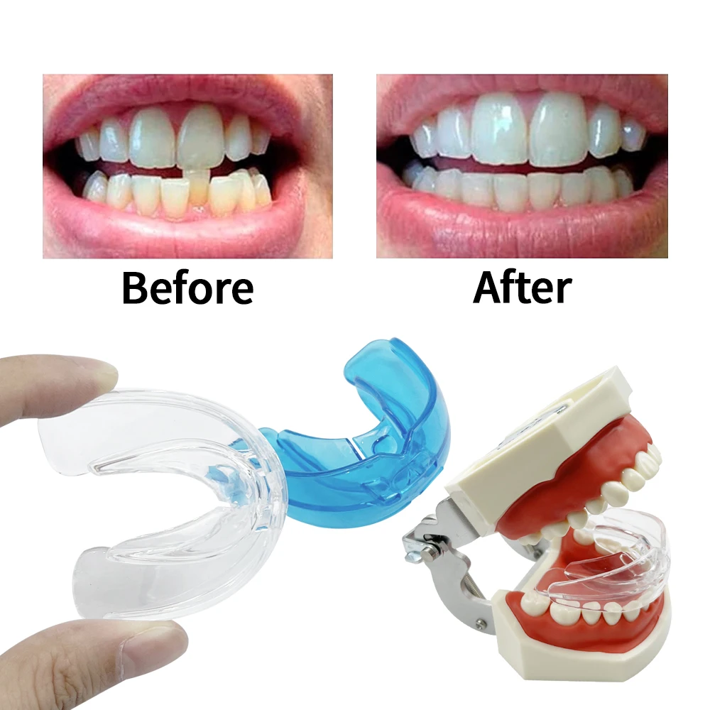 Orthodontic Braces Dental Braces Smile Teeth Alignment Trainer Instanted Silicone Teeth Retainer Mouth Guard Braces Tooth 2026