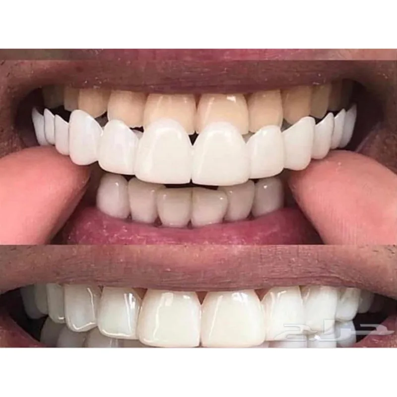 Latest Snap on Smile Dental Upper Lower Fake Teeth Cover Perfect Bright Veneers Comfort Fit Flex Dentures Braces Whitening
