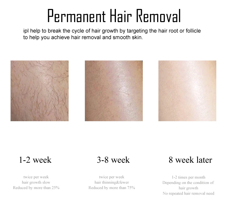 KODO 2026 New Laser Hair Removal Dropshipping Hot Sell Laser Epilator Permanent IPL Painless Photoepilator Bikini Face and Body