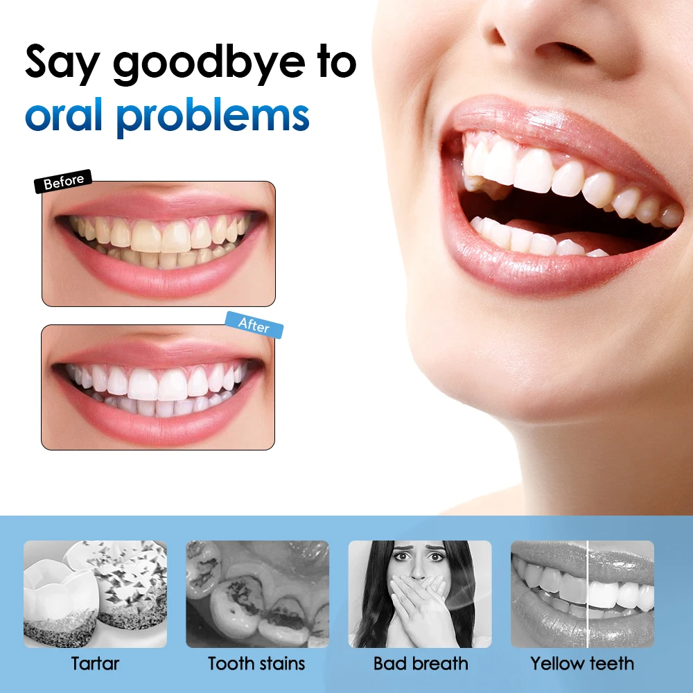 Electric ToothBrush Whitening Frequency Sonic Teeth Cleaner Dental Scaler Toothbrush Calculus Plaque Remover Stone Remover Kit