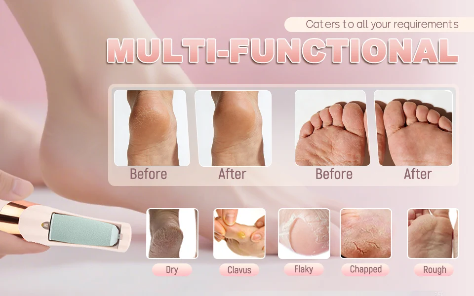 LQT Electric Foot Grinder Automatic Foot Callus Rubbing Pedicure Dead Skin Callus Remover for Foot Beauty Machine