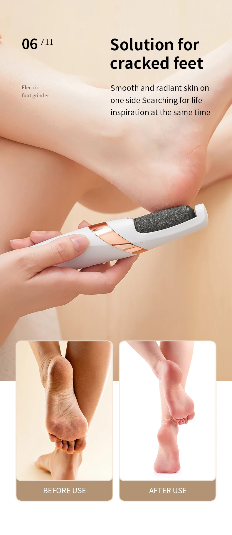 Cordless Rechargeable Electric Callus Remover, Foot File for Dry Coarse Skin Removal on Heels, for Women & Men