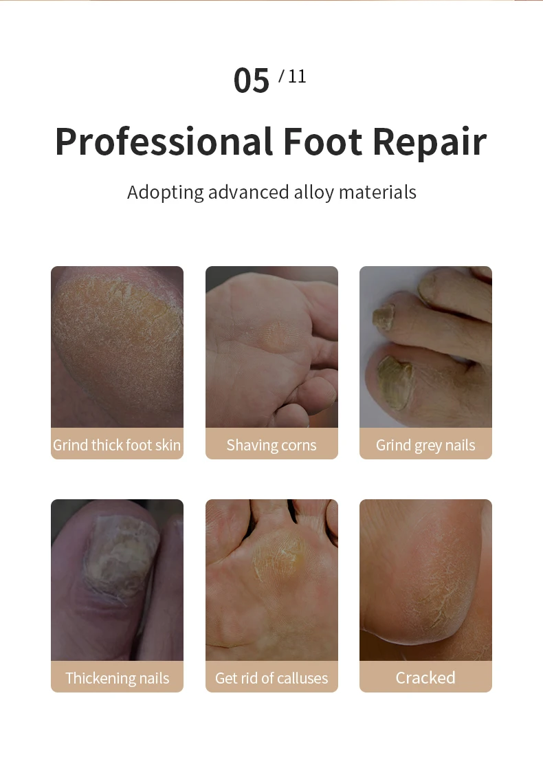 Cordless Rechargeable Electric Callus Remover, Foot File for Dry Coarse Skin Removal on Heels, for Women & Men