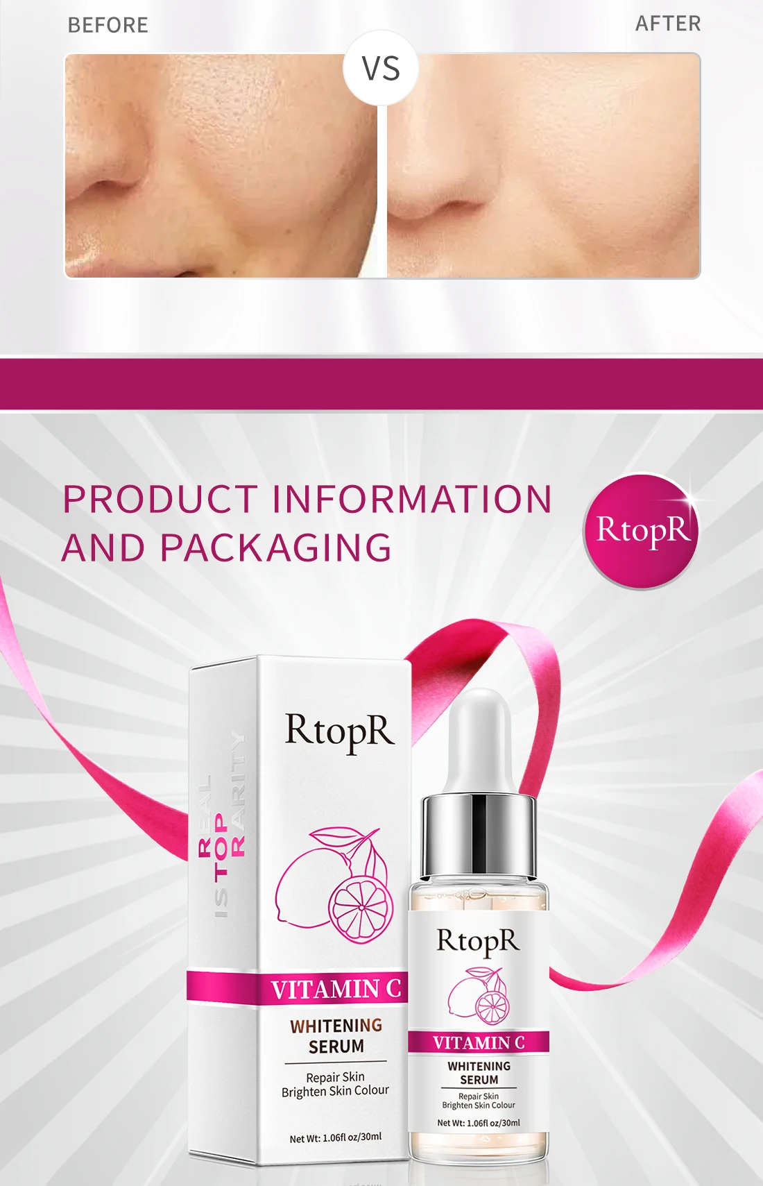 RtopR Vitamin C Whitening Essence Brightens Skin Removes Freckles Repairs Face Skin Wrinkles Lifts Firms Anti-Aging Face Care