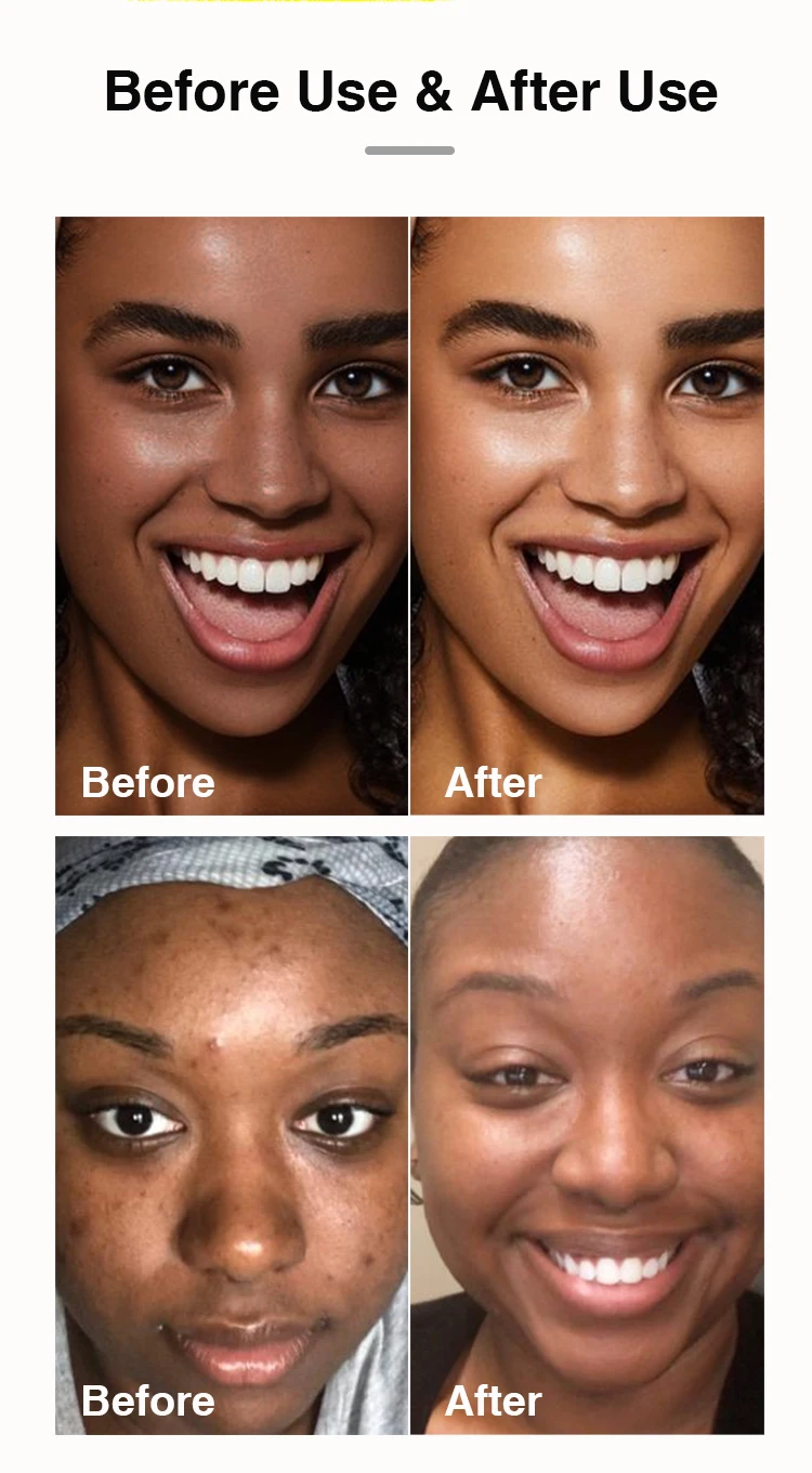 AILKE Organic Turmeric Skin Care Set, Brighten, Cleaning Skin, Remove Acne,Pimples, Whitening, Even Skin Tone, Improve Dry Skin