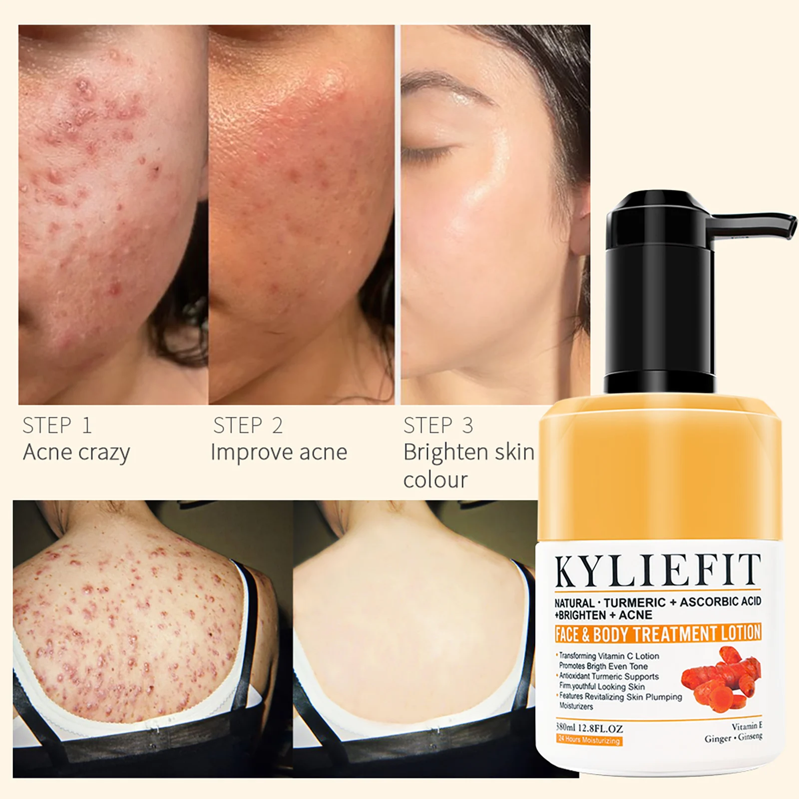 AILKE Organic Turmeric Skin Care Set, Brighten, Cleaning Skin, Remove Acne,Pimples, Whitening, Even Skin Tone, Improve Dry Skin