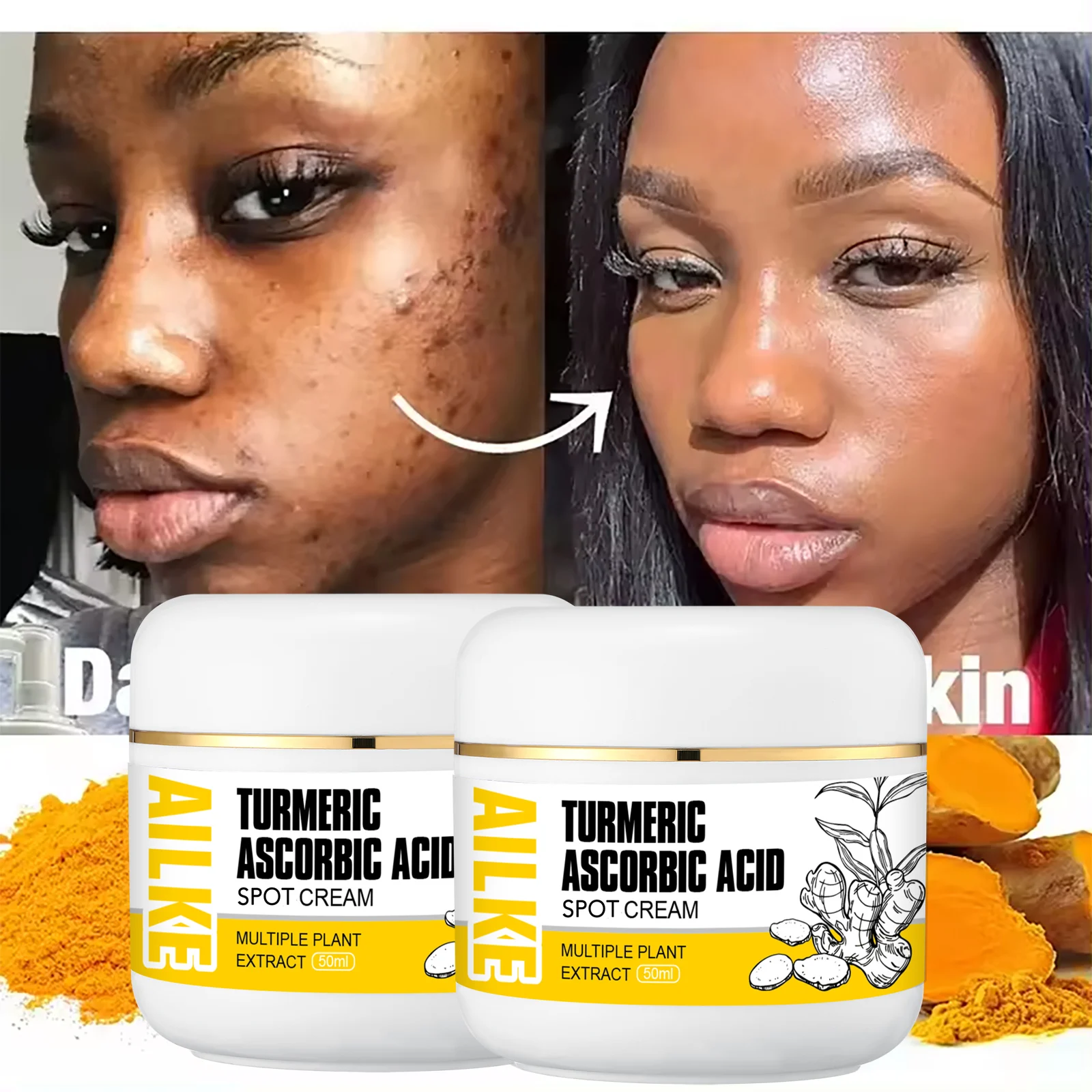 AILKE Organic Turmeric Skin Care Set, Brighten, Cleaning Skin, Remove Acne,Pimples, Whitening, Even Skin Tone, Improve Dry Skin