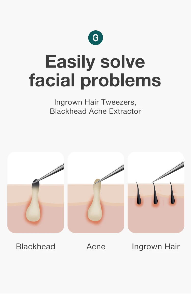 MR.GREEN Ingrown Hair Tweezers Needle Nose Pointed Tips Eyebrows Tweezers For Splinters Blackhead Removal Acne Clip Extractor