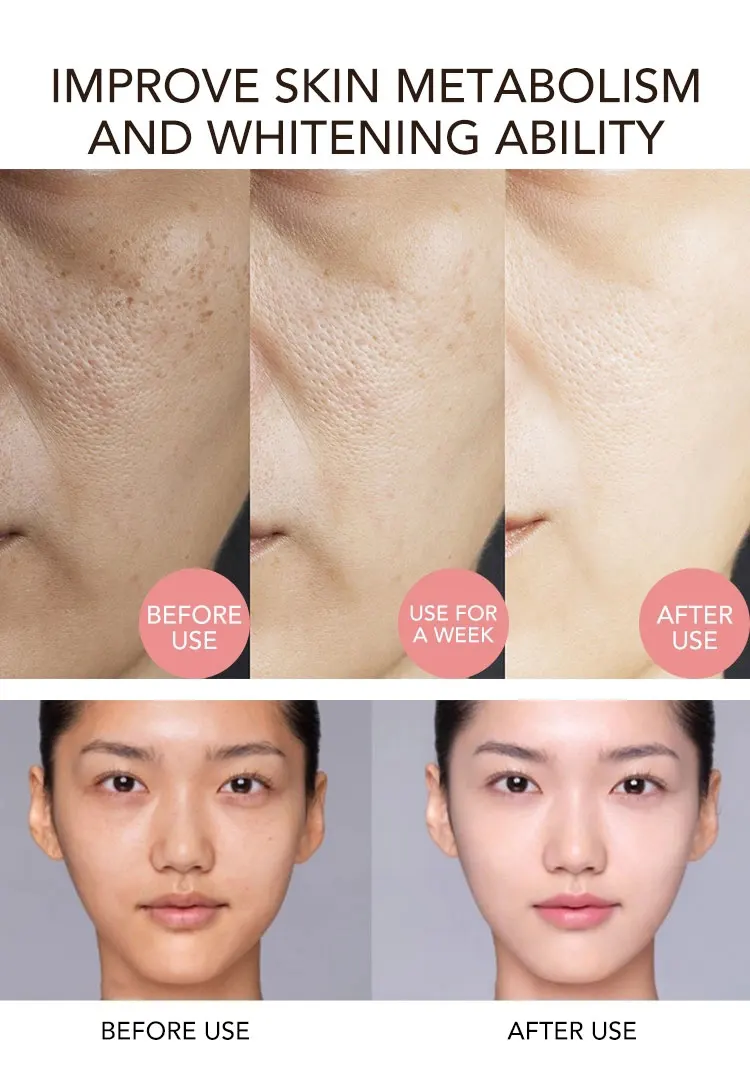 AILKE Whitening Face Cream, Reduce Dark Spots, Sun Spots, Melanin, With Collagen, Glutathione, Even Skin Tone For All Skin Types