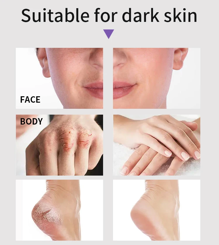 AILKE Whitening Skin Care Set, With Nicotinamide, Glutathione, Moisturizing, Even Skin Tone, Remove Dark Spot, Freckle, Melanin