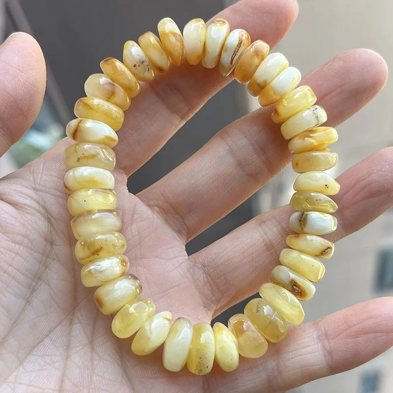 Yoowei Baltic Medical Amber Bracelet for Unisex Original Handmade Fashion Diy Healing Yellow Amber Jewelry Accessories Wholesale