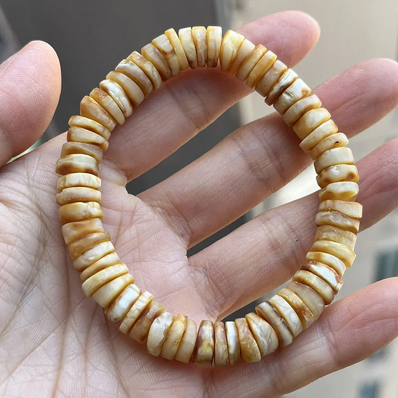 Yoowei Baltic Medical Amber Bracelet for Unisex Original Handmade Fashion Diy Healing Yellow Amber Jewelry Accessories Wholesale