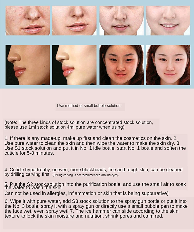 1200ML 3pcs/Lot Hydrofacial Liquid Face Serum Facial Aqua Peel Solution AS1 SA2 AO3 For Beauty Machine SkinCare Deep Cleaning